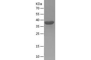 Western Blotting (WB) image for Elastin Microfibril Interfacer 1 (EMILIN1) (AA 676-1016) protein (His tag) (ABIN7283357) (Emilin1 Protein (AA 676-1016) (His tag))