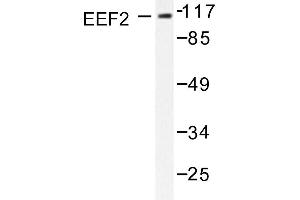 Image no. 1 for anti-Eukaryotic Translation Elongation Factor 2 (EEF2) antibody (ABIN265392) (EEF2 抗体)
