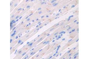 Used in DAB staining on fromalin fixed paraffin- embedded heart tissue (Triadin 抗体  (AA 344-693))