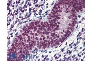 Immunohistochemistry (IHC) image for anti-Ewing Sarcoma Breakpoint Region 1 (EWSR1) (Internal Region) antibody (ABIN335135)