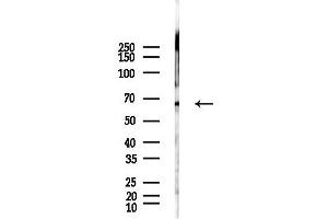 Western blot analysis of lysates from Hela cells(LPS, 4h treatment), using Estrogen Receptor-alpha Antibody at 1/1000 dilution.