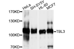 Western blot analysis of extracts of various cell lines, using TBL3 antibody (ABIN4905375) at 1:1000 dilution. (TBL3 抗体)