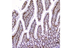 IHC analysis of AHR using anti-AHR antibody (ABIN6719265).