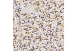 Immunohistochemistry (Paraffin-embedded Sections) (IHC (p)) image for anti-Histone 3 (H3) (H3K36me2) antibody (ABIN3016036)