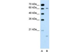Western Blotting (WB) image for anti-Cytochrome P450, Family 4, Subfamily A, Polypeptide 22 (CYP4A22) antibody (ABIN2462485) (CYP4A22 抗体)