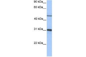 WB Suggested Anti-EPHX1 Antibody Titration: 0. (EPHX1 抗体  (Middle Region))
