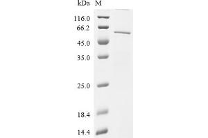 (Tris-Glycine gel) Discontinuous SDS-PAGE (reduced) with 5 % enrichment gel and 15 % separation gel.