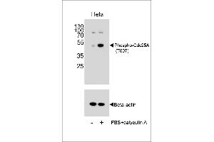 Western blot analysis of extracts from Hela cells, untreated or treated with calyculin A, using Phospho-Cdc25A Antibody . (CDC25A 抗体  (pThr507))