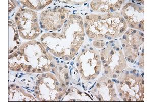 Immunohistochemical staining of paraffin-embedded Human Kidney tissue using anti-CYP1A2 mouse monoclonal antibody. (CYP1A2 抗体)