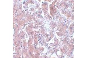 Immunohistochemistry (IHC) image for anti-ELOVL Fatty Acid Elongase 7 (ELOVL7) (N-Term) antibody (ABIN1031366) (ELOVL7 抗体  (N-Term))