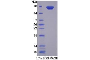 SDS-PAGE analysis of Human PUF60 Protein. (PUF60 蛋白)