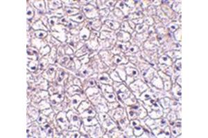 Image no. 1 for anti-Cytokine Receptor-Like Factor 2 (CRLF2) (Middle Region) antibody (ABIN318884) (CRLF2 抗体  (Middle Region))