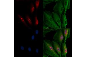 ABIN7094490 and ABIN7098539 staining  cells by IF/ICC. (Transportin 1 抗体  (C-Term))