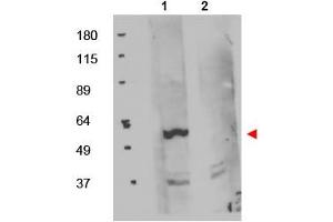 Image no. 1 for anti-FK506 Binding Protein 8, 38kDa (FKBP8) (Internal Region) antibody (ABIN401051) (FKBP8 抗体  (Internal Region))