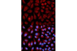 Immunofluorescence (IF) image for anti-Vimentin (VIM) (AA 1-200) antibody (ABIN3016292) (Vimentin 抗体  (AA 1-200))