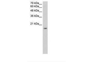 Image no. 2 for anti-Zinc Finger Protein 580 (ZNF580) (AA 31-80) antibody (ABIN6736331) (ZNF580 抗体  (AA 31-80))