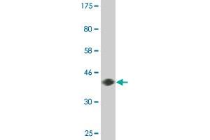 Western Blot detection against Immunogen (36. (DYRK2 抗体  (AA 1-100))