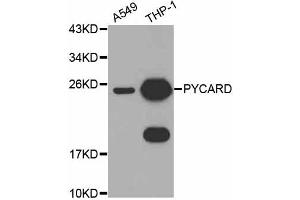 Western blot analysis of extracts of various cell lines, using PYCARD antibody (ABIN4904914) at 1:1000 dilution. (PYCARD 抗体)