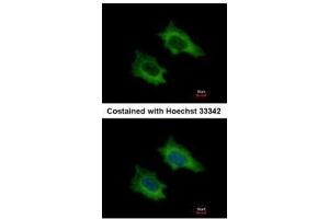 ICC/IF Image Immunofluorescence analysis of methanol-fixed HeLa, using PRPSAP2, antibody at 1:500 dilution. (PRPSAP2 抗体)