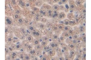Detection of MIP1b in Mouse Liver Tissue using Polyclonal Antibody to Macrophage Inflammatory Protein 1 Beta (MIP1b) (CCL4 抗体  (AA 24-92))