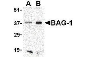 Western Blotting (WB) image for anti-BCL2-Associated Athanogene (BAG1) (C-Term) antibody (ABIN2477576) (BAG1 抗体  (C-Term))