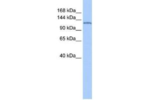 WB Suggested Anti-NUP155 Antibody Titration: 0. (NUP155 抗体  (N-Term))
