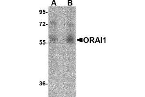 Western Blotting (WB) image for anti-ORAI Calcium Release-Activated Calcium Modulator 1 (ORAI1) (C-Term) antibody (ABIN492545) (ORAI1 抗体  (C-Term))
