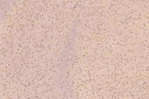 Immunohistochemistry (Paraffin-embedded Sections) (IHC (p)) image for anti-Kinesin Family Member 5B (KIF5B) antibody (ABIN7074440)