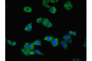 Immunofluorescent analysis of HepG2 cells using ABIN7172795 at dilution of 1:100 and Alexa Fluor 488-congugated AffiniPure Goat Anti-Rabbit IgG(H+L) (Transferrin Receptor 抗体  (AA 94-754))