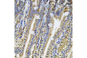 Immunohistochemistry of paraffin-embedded mouse intestine using NFU1 Antibody (ABIN2564134) at dilution of 1:100 (40x lens). (NFU1 抗体)