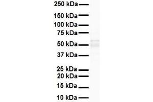 WB Suggested Anti-PPARA antibody Titration: 1 ug/mL Sample Type: Human heart (PPARA 抗体  (N-Term))