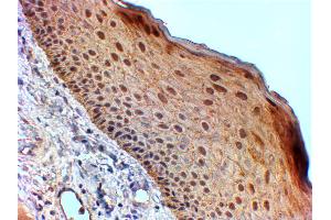 Immunohistochemistry (IHC) image for anti-Stratifin (SFN) (Internal Region) antibody (ABIN185539)