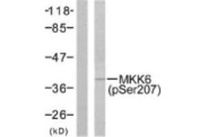 Image no. 1 for anti-Mitogen-Activated Protein Kinase Kinase 6 (MAP2K6) (pSer207) antibody (ABIN318071) (MAP2K6 抗体  (pSer207))