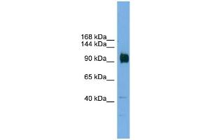 WB Suggested Anti-Zfp445 Antibody Titration:  0. (ZNF445 抗体  (Middle Region))