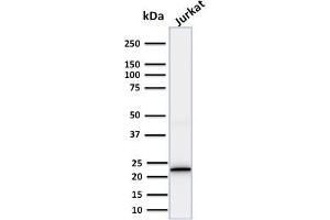 Western Blot Analysis of human Jurkat cell lysate using CD3e Mouse Monoclonal Antibody (PC3/188A).