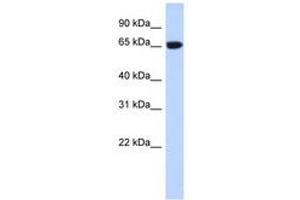 Image no. 1 for anti-GTP Binding Protein 2 (GTPBP2) (AA 35-84) antibody (ABIN6740772) (GTPBP2 抗体  (AA 35-84))