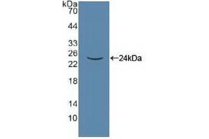 Detection of Recombinant PANX1, Human using Polyclonal Antibody to Pannexin 1 (PANX1) (PANX1 抗体  (AA 228-411))