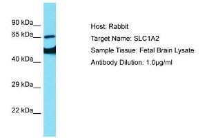 Western Blotting (WB) image for anti-Solute Carrier Family 1 (Glial High Affinity Glutamate Transporter), Member 2 (SLC1A2) (N-Term) antibody (ABIN2778148)