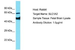 Host:  Rabbit  Target Name:  SLC1A2  Sample Type:  Fetal Brain lysates  Antibody Dilution:  1. (SLC1A2 抗体  (N-Term))