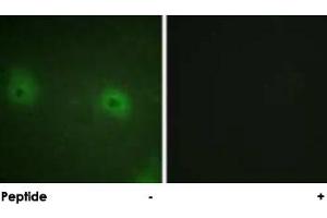 Immunofluorescence analysis of HUVEC cells, using STAM2 polyclonal antibody . (STAM2 抗体)