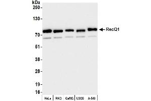 Western Blotting (WB) image for anti-RecQ Protein-Like (DNA Helicase Q1-Like) (RECQL) (AA 1-50) antibody (ABIN7453821) (RecQ Protein-Like (DNA Helicase Q1-Like) (RECQL) (AA 1-50) 抗体)