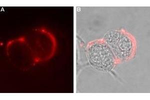 Expression of GABRA6 in rat PC12 cells - Cell surface detection of GABRA6 in intact living rat pheochromocytoma (PC12) cells.