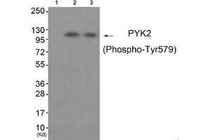 Western blot analysis of extracts from 3T3 cells (Lane 2) and HepG2 cells (Lane 3), using PYK2 (Phospho-Tyr579) Antibody.