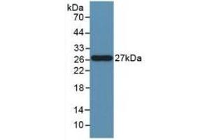 Detection of Recombinant FASL, Human using Polyclonal Antibody to Factor Related Apoptosis Ligand (FASL) (FASL 抗体)