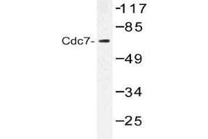 Western blot (WB) analysis of Cdc7 antibody in extracts from Jurkat cells. (CDC7 抗体)