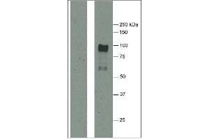 Western Blotting (WB) image for anti-Fibrinogen (citrullinated) antibody (ABIN1107223) (Fibrinogen 抗体  (citrullinated))