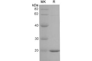 Western Blotting (WB) image for Lipocalin 2 (LCN2) protein (His tag) (ABIN7320880) (Lipocalin 2 Protein (LCN2) (His tag))