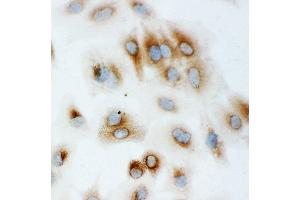 Anti-Hsp70 antibody, ICC ICC: A549 Cell (HSP70 1A 抗体  (C-Term))