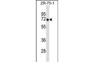 Western blot analysis in ZR-75-1 cell line lysates (35ug/lane). (ZNF654 抗体  (C-Term))