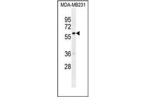 Western blot analysis of GNL3L Antibody (N-term) in MDA-MB231 cell line lysates (35ug/lane). (GNL3L 抗体  (N-Term))
